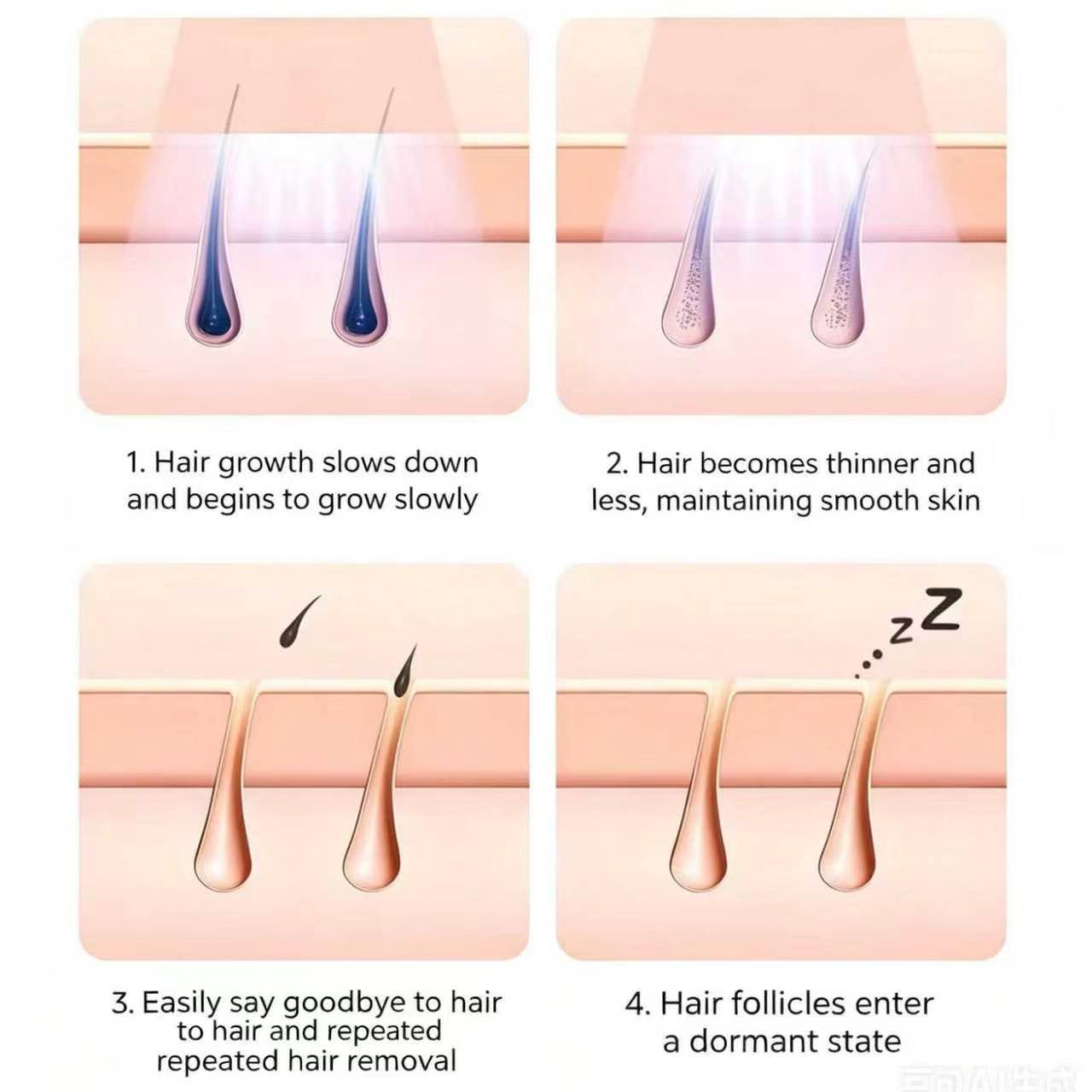 Mlay hair removal package
